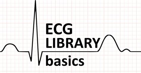 ecg for dummies|ECG Interpretation: The Basics • LITFL • Video lecture.